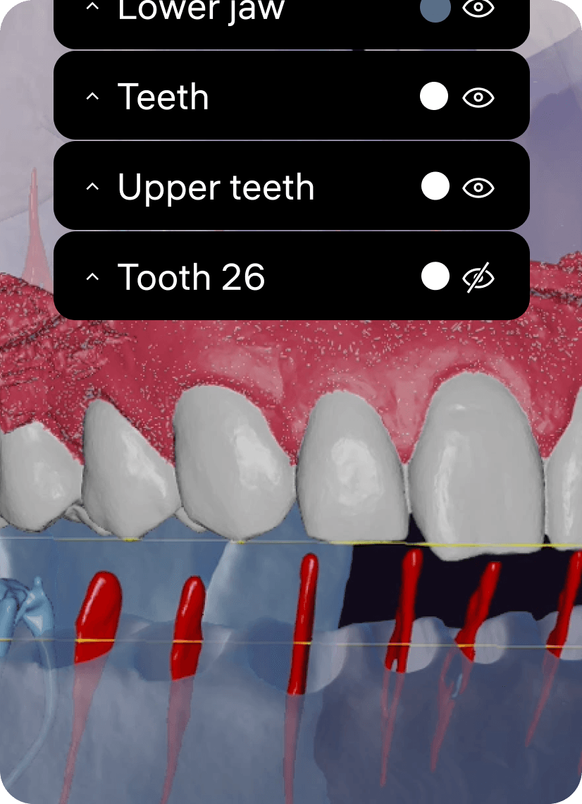 CBCT