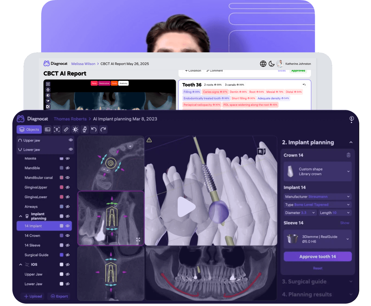 [object Object], Learn how to use Diagnocat with step-by-step videos and guidance from our clinical specialists.