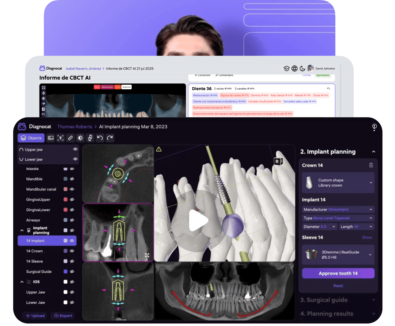 [object Object], Aprenda a utilizar Diagnocat con videos paso a paso y la orientación de nuestros especialistas clínicos.