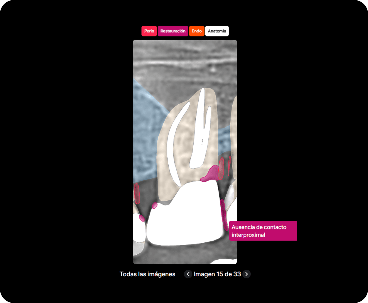 [object Object], las patologías seleccionadas mediante etiquetas de áreas críticas (CATs) codificadas por colores en la imagen.