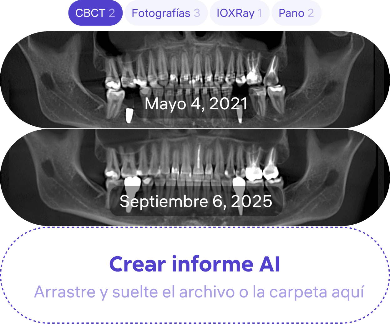 [object Object], para reunir y almacenar el historial clínico y la información médica del paciente.