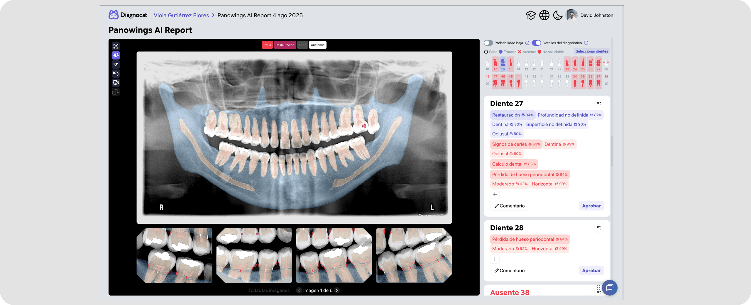 [object Object], y panorámicas obtenidas en una misma sesión se integran automáticamente en un informe híbrido único, brindando una visión clínica completa que respalda su proceso diagnóstico.
