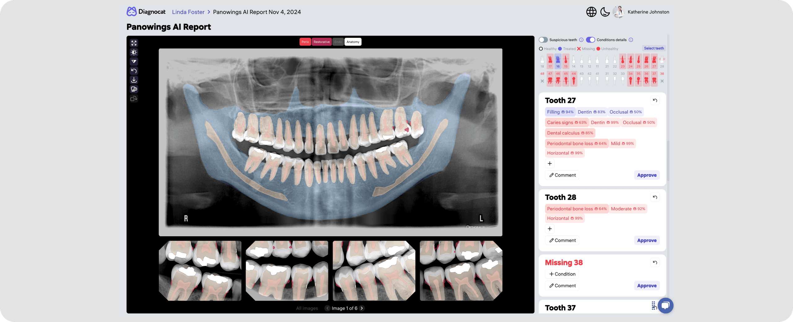 [object Object], taken in one session are automatically combined into a single hybrid report for a comprehensive clinical overview to support your diagnosis process.