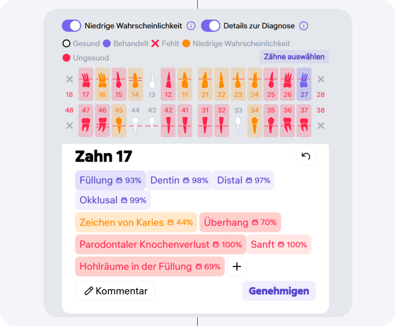 [object Object], Die Zähne leuchten gelb, wenn die Wahrscheinlichkeit für Karies und periapikale Veränderungen zwischen 30 % und 50 % liegt.