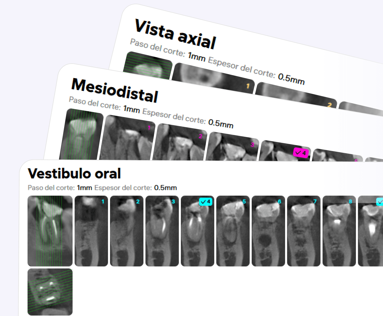[object Object], Este panel incluye un conjunto extenso de cortes generados automáticamente en los tres planos.