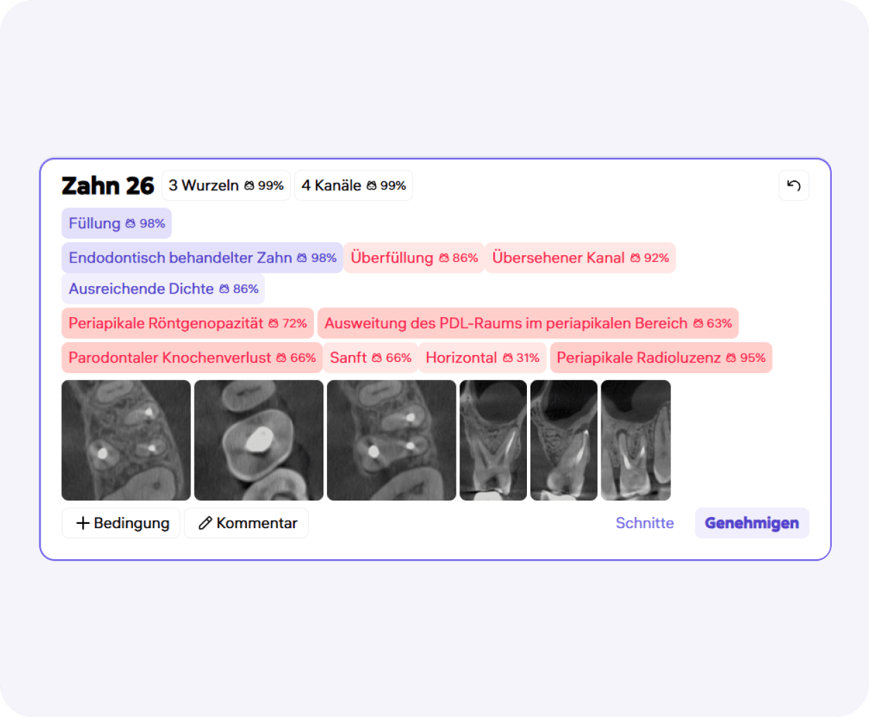 [object Object], darunter 20 endodontische Merkmale.