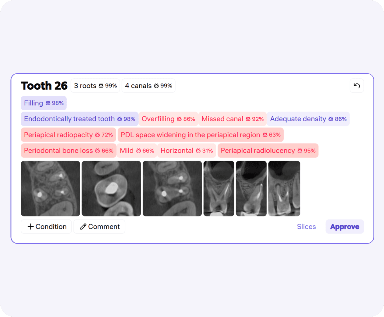 [object Object], including 20 endodontic features.