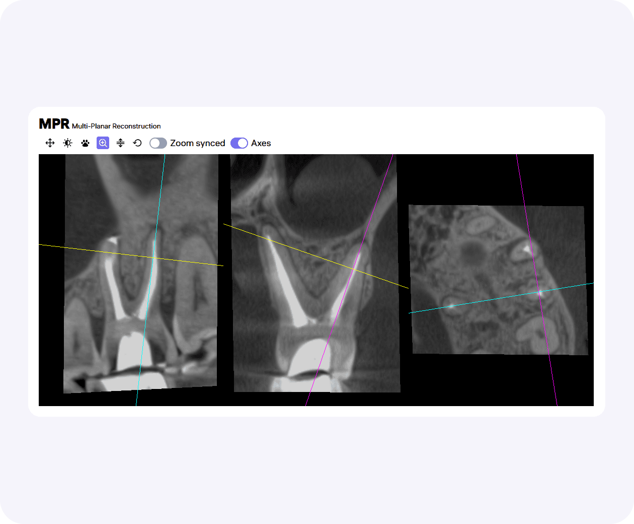 [object Object], is integrated into the radiology report and allows analysis of the selected region of interest.