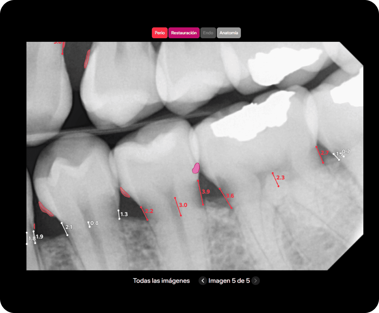 [object Object], en imágenes 2D en milímetros.