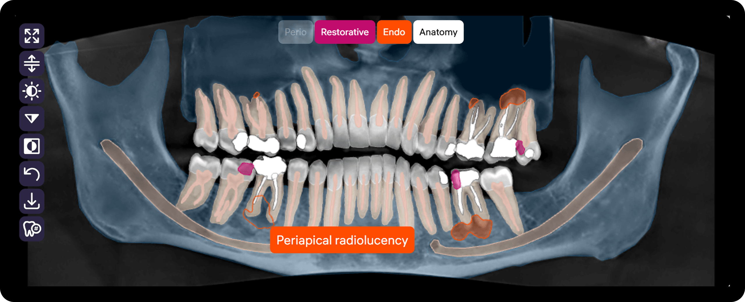 [object Object], (Critical Area Tags) that highlight detected pathologies across all image types for quick navigation.