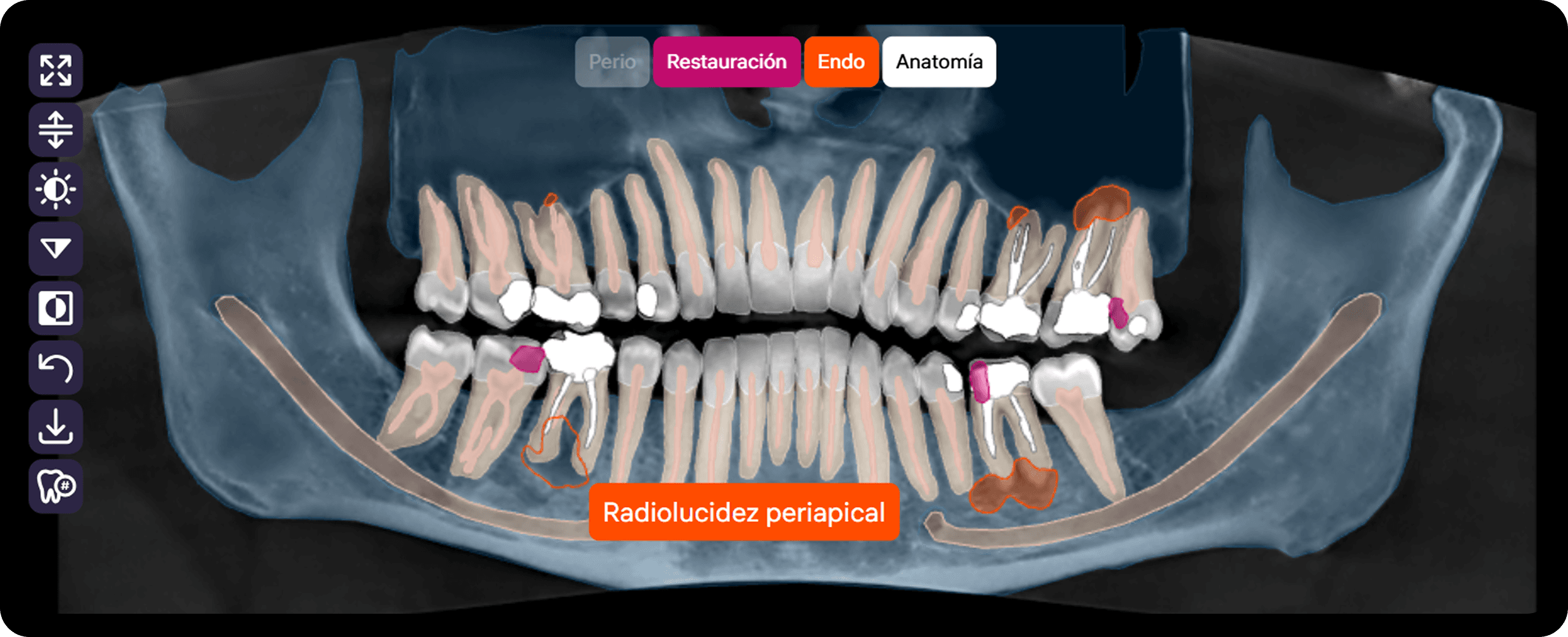 [object Object], (Critical Area Tags), que resaltan las patologías detectadas en todos los tipos de imágenes para una navegación rápida.