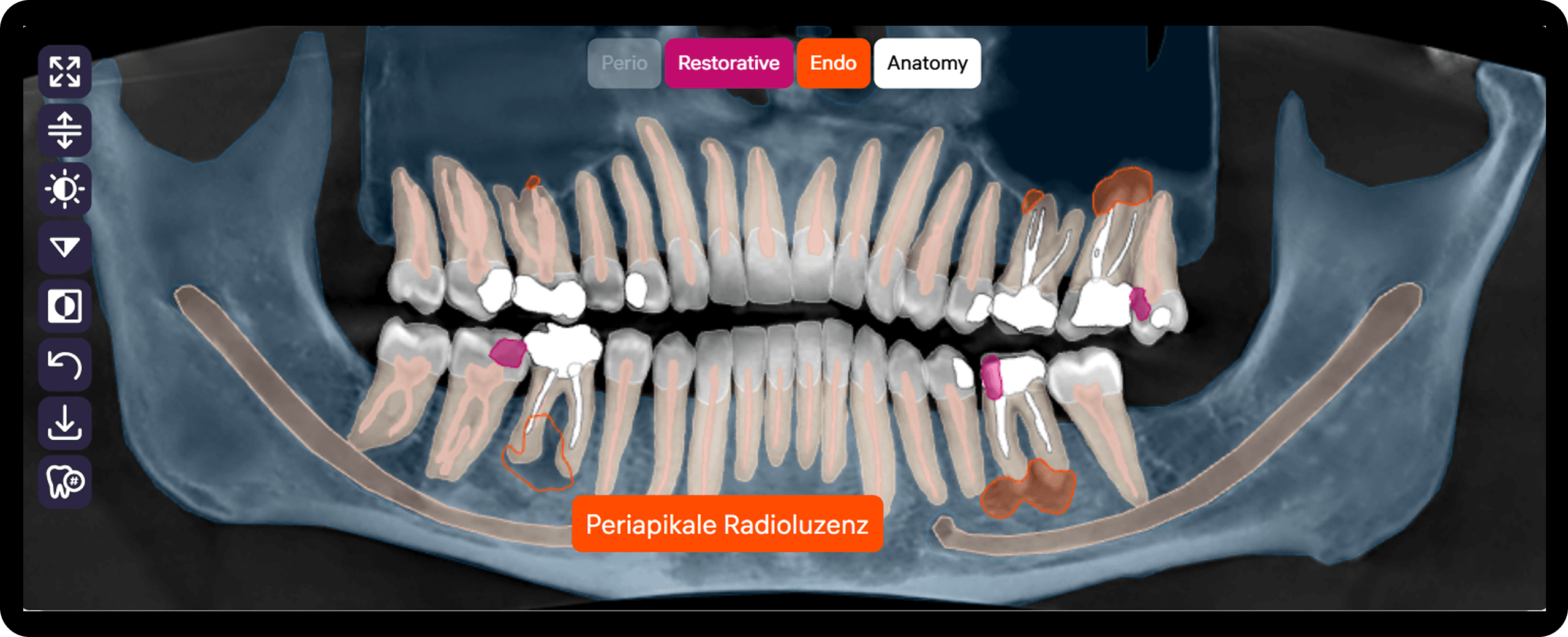 Anzeige von Pathologiemasken auf allen Bildtypen zur schnellen Navigation.