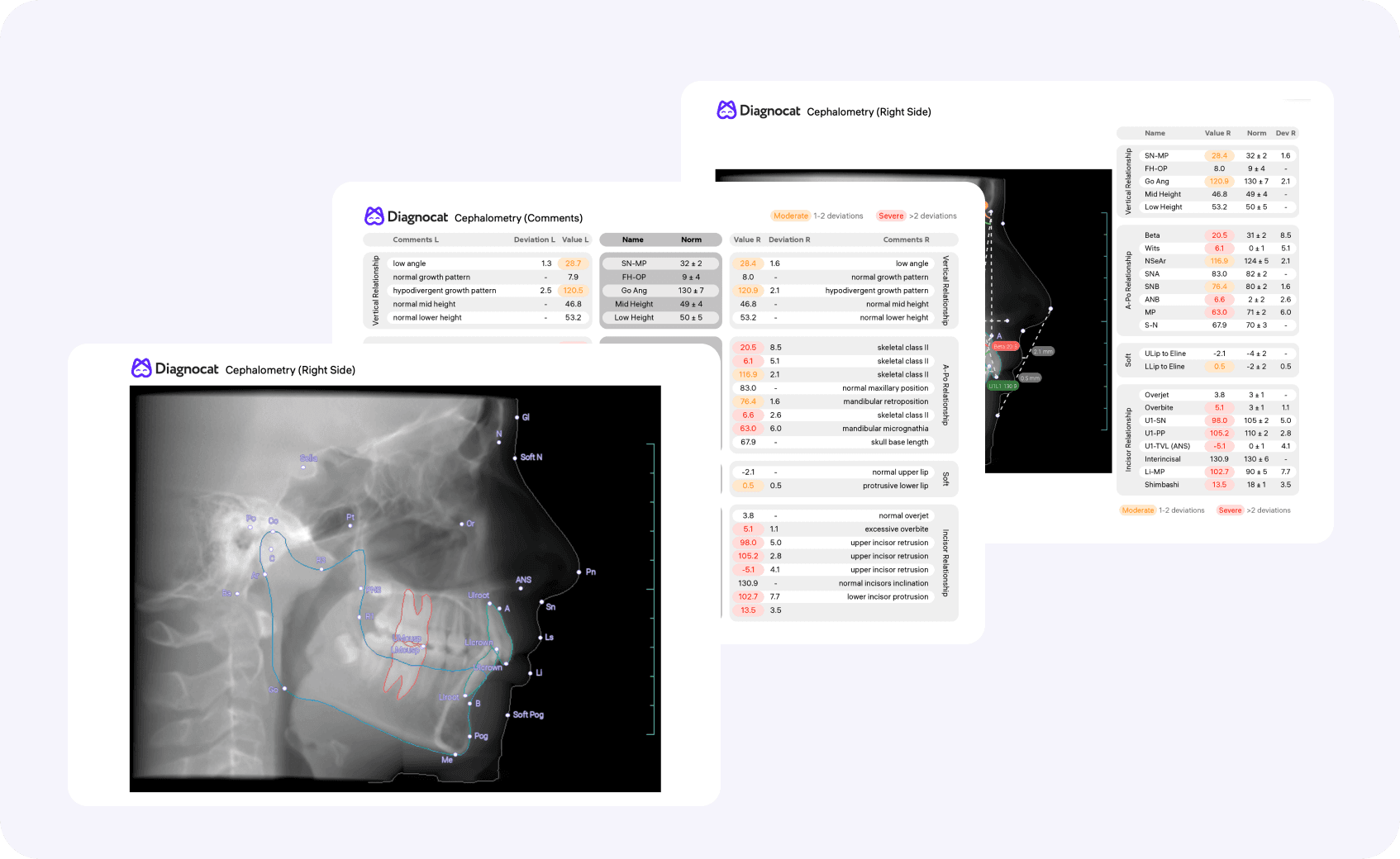 [object Object], offer a convenient way to present your clinical conclusions and visualizations, helping boost treatment acceptance at your clinic.