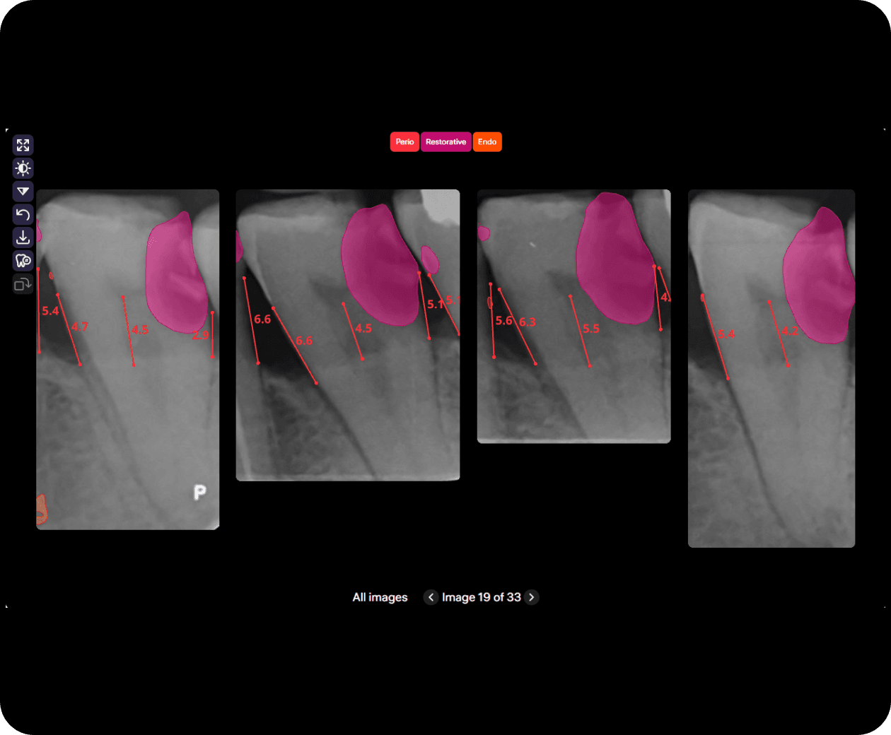 [object Object], offers a convenient visualization of each individual tooth to highlight a specific area of interest.
