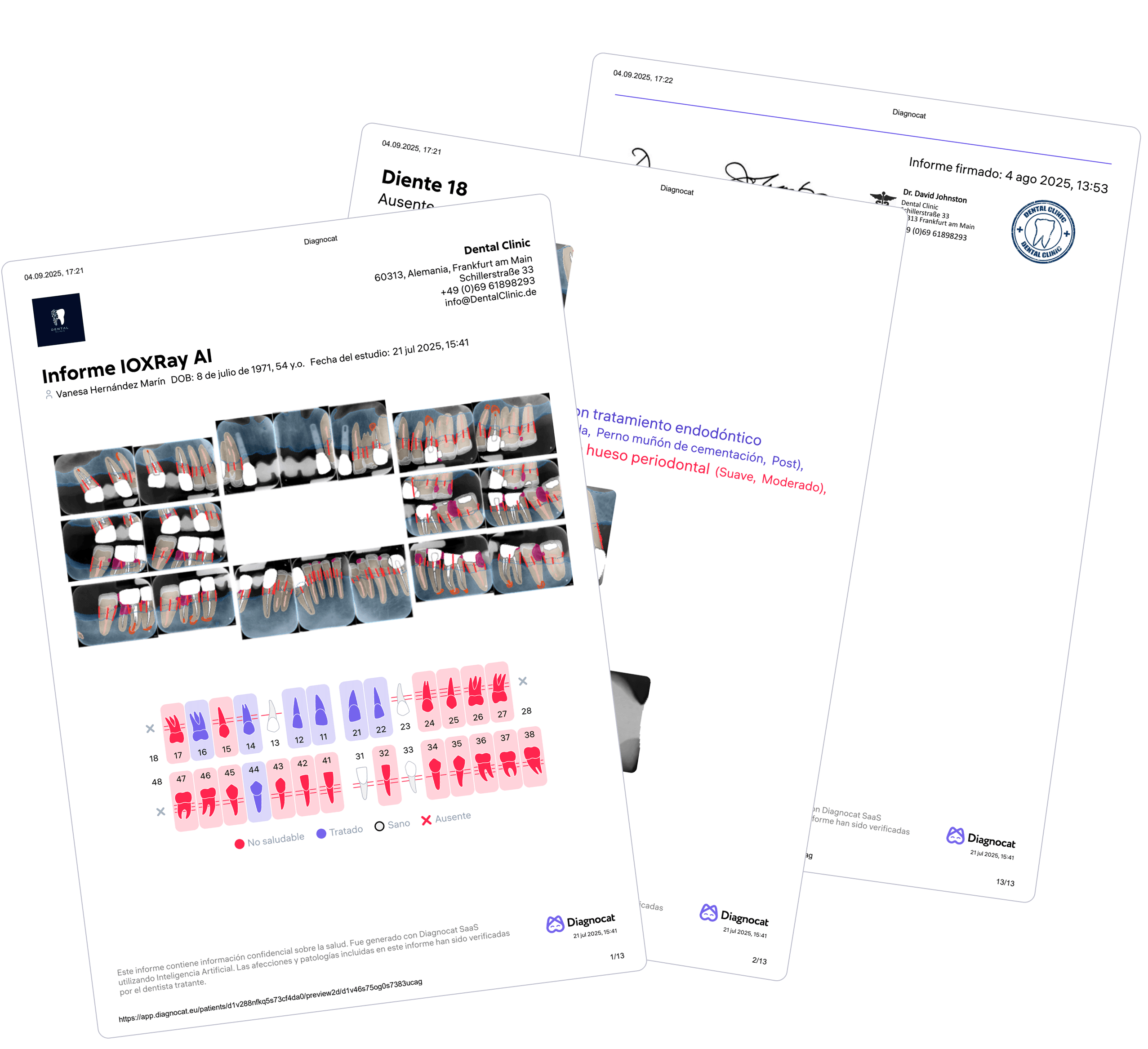 Radiografías intraorales