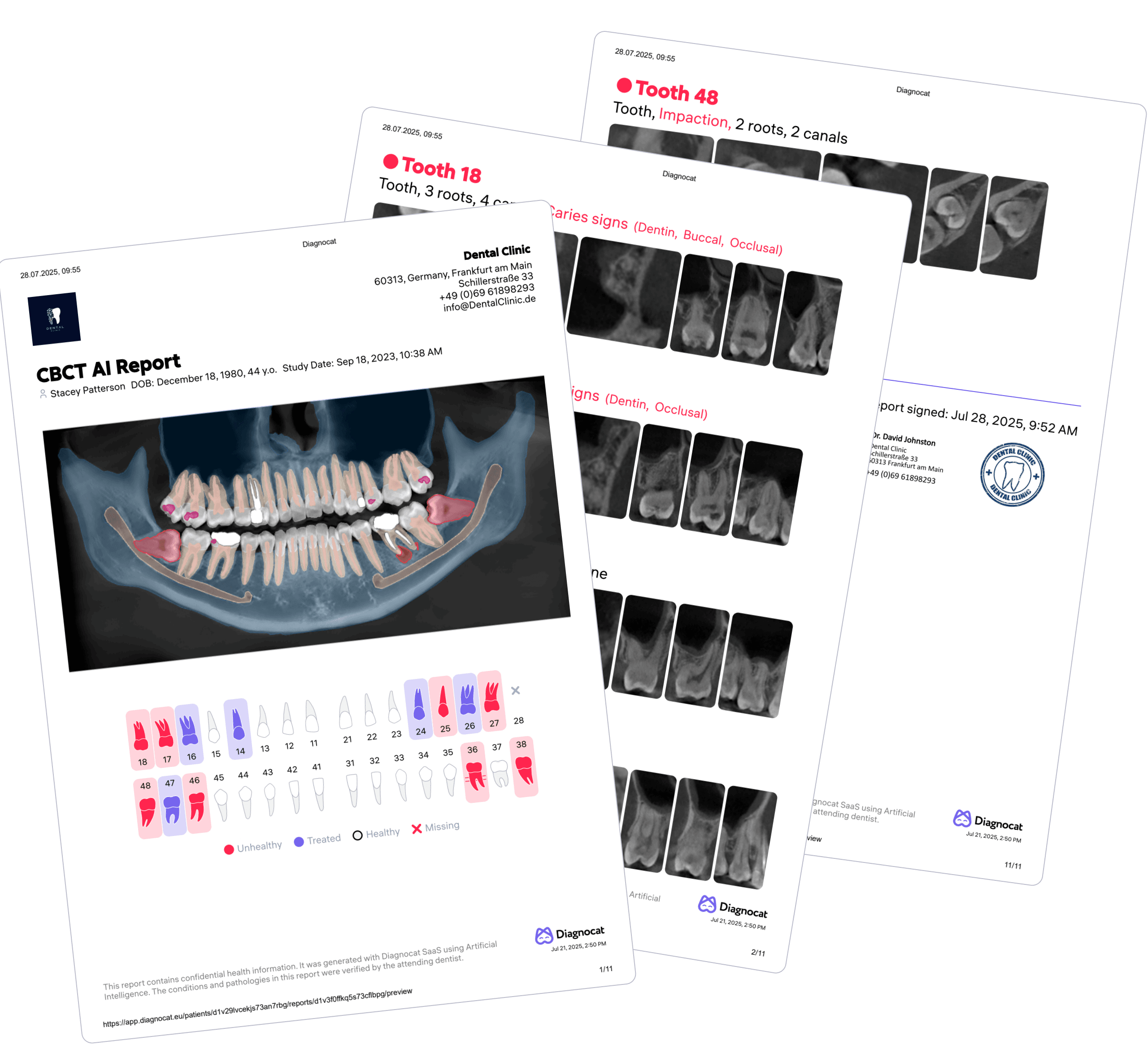 CBCT