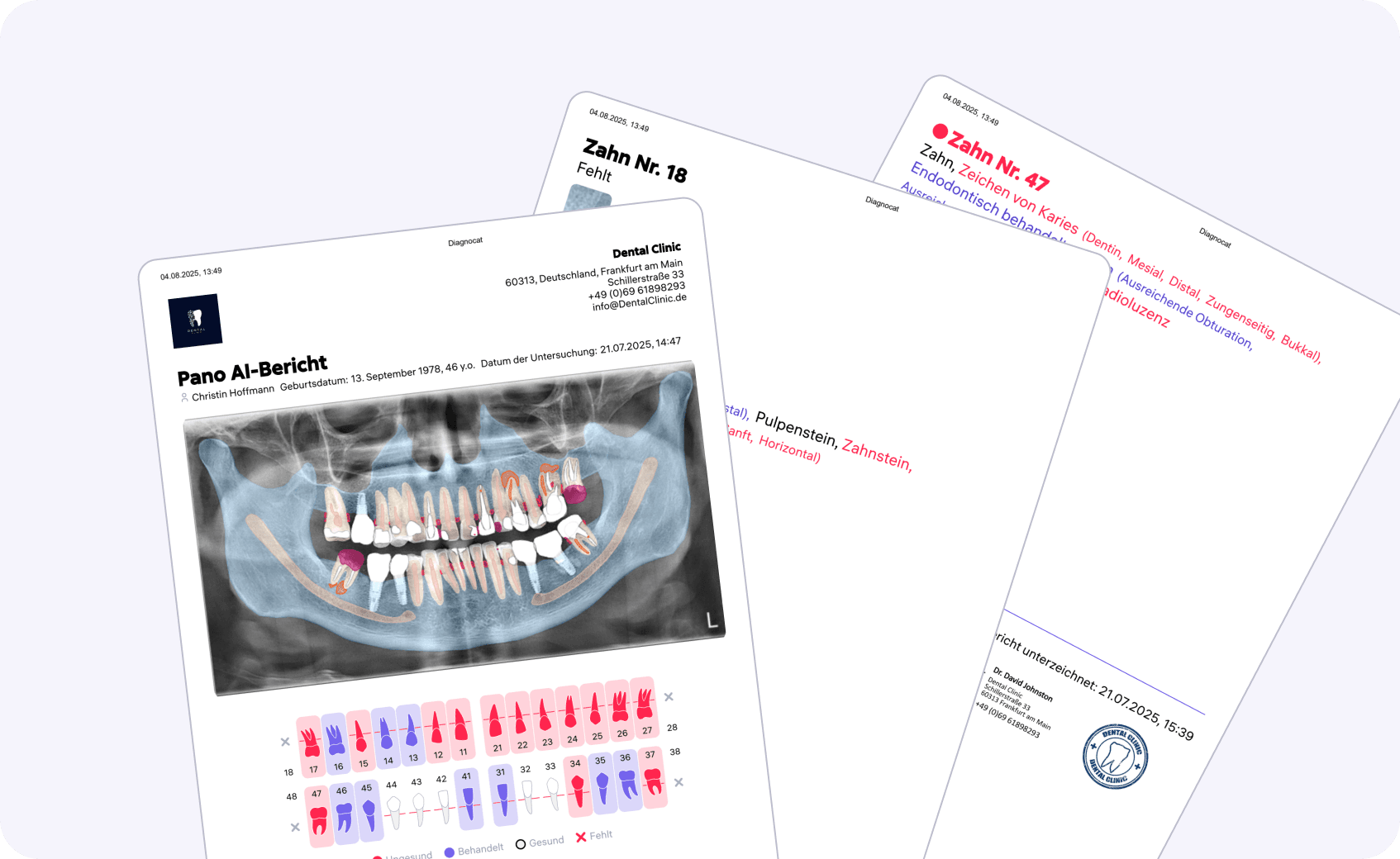 [object Object], dabei, die klinische Situation des Patienten klar zu erklären. Sie enthalten eine Visualisierung der Pathologien, die Möglichkeit, die Meinung des Arztes hinzuzufügen und personalisierte Behandlungsempfehlungen zu geben.