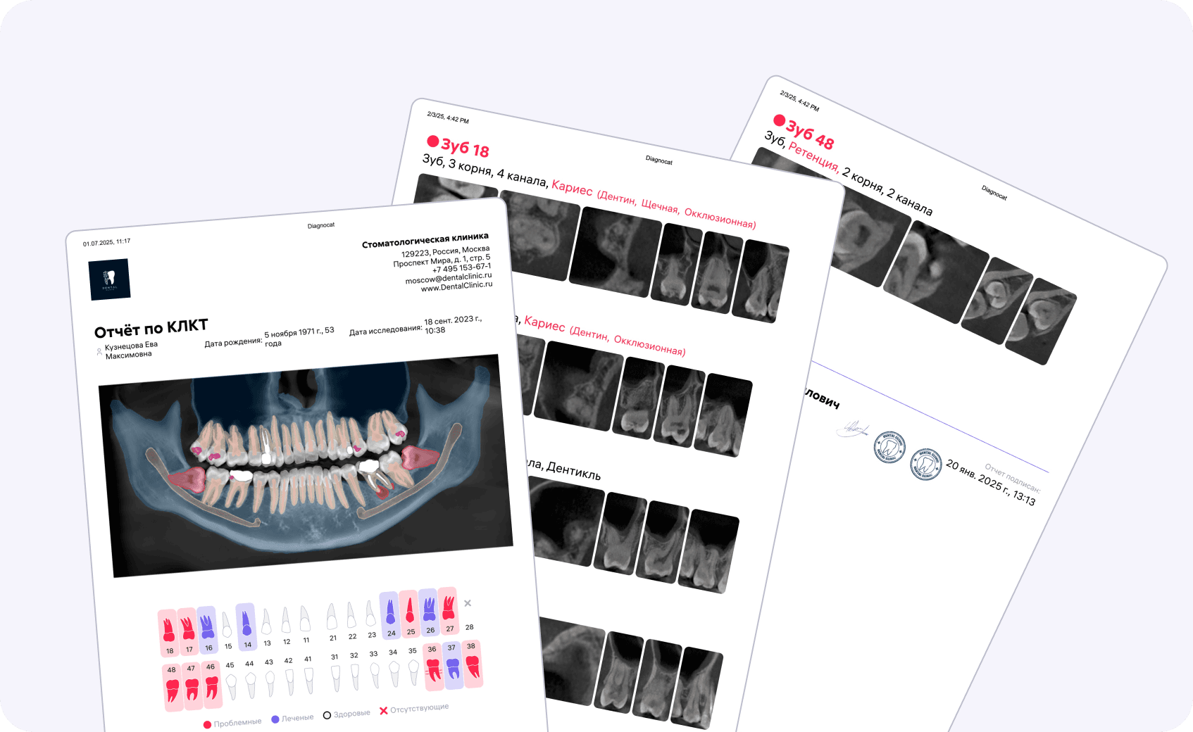 [object Object], dabei, die klinische Situation des Patienten klar zu erklären. Sie enthalten eine Visualisierung der Pathologien, die Möglichkeit, die Meinung des Arztes hinzuzufügen und personalisierte Behandlungsempfehlungen zu geben.