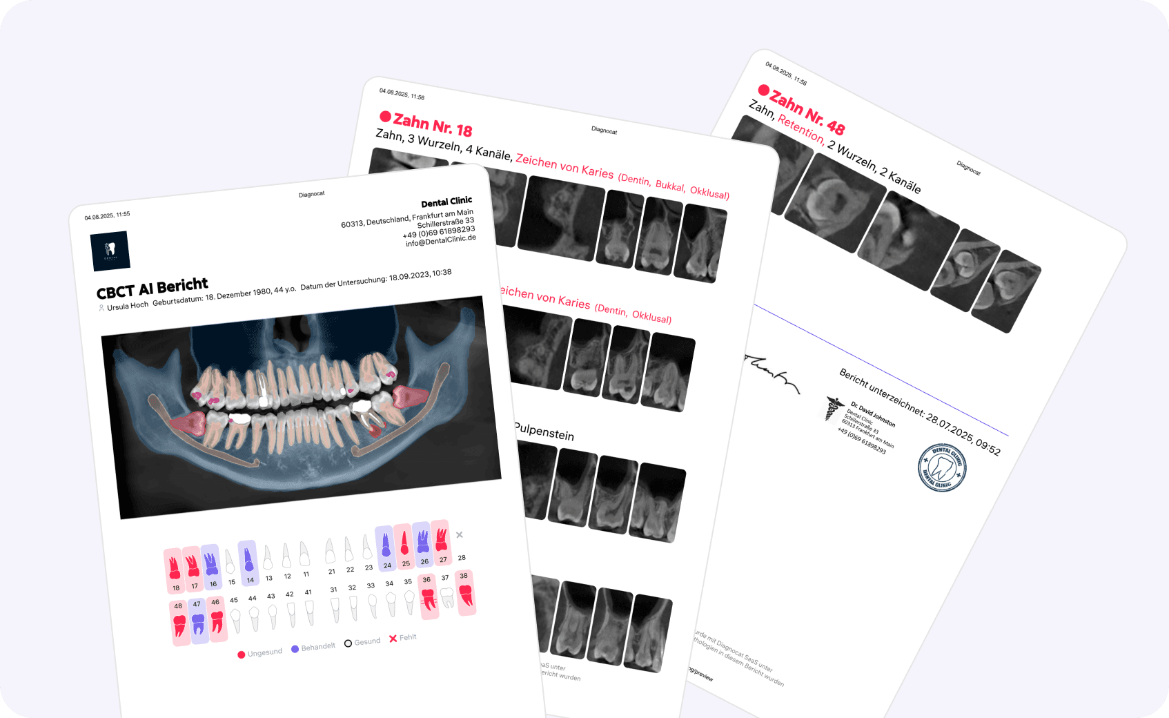[object Object], dabei, die klinische Situation des Patienten klar zu erklären. Sie enthalten eine Visualisierung der Pathologien, die Möglichkeit, die Meinung des Arztes hinzuzufügen und personalisierte Behandlungsempfehlungen zu geben.