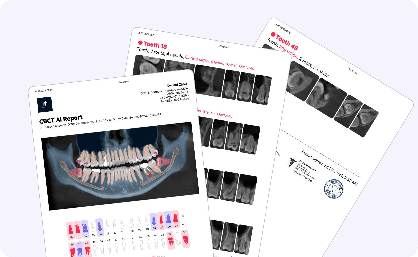 [object Object], dabei, die klinische Situation des Patienten klar zu erklären. Sie enthalten eine Visualisierung der Pathologien, die Möglichkeit, die Meinung des Arztes hinzuzufügen und personalisierte Behandlungsempfehlungen zu geben.