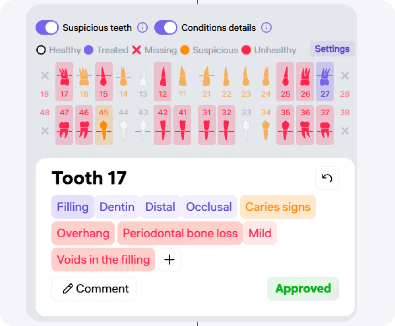 [object Object], Teeth are illuminated yellow when the probability of caries and periapical changes is between 30% and 50%.