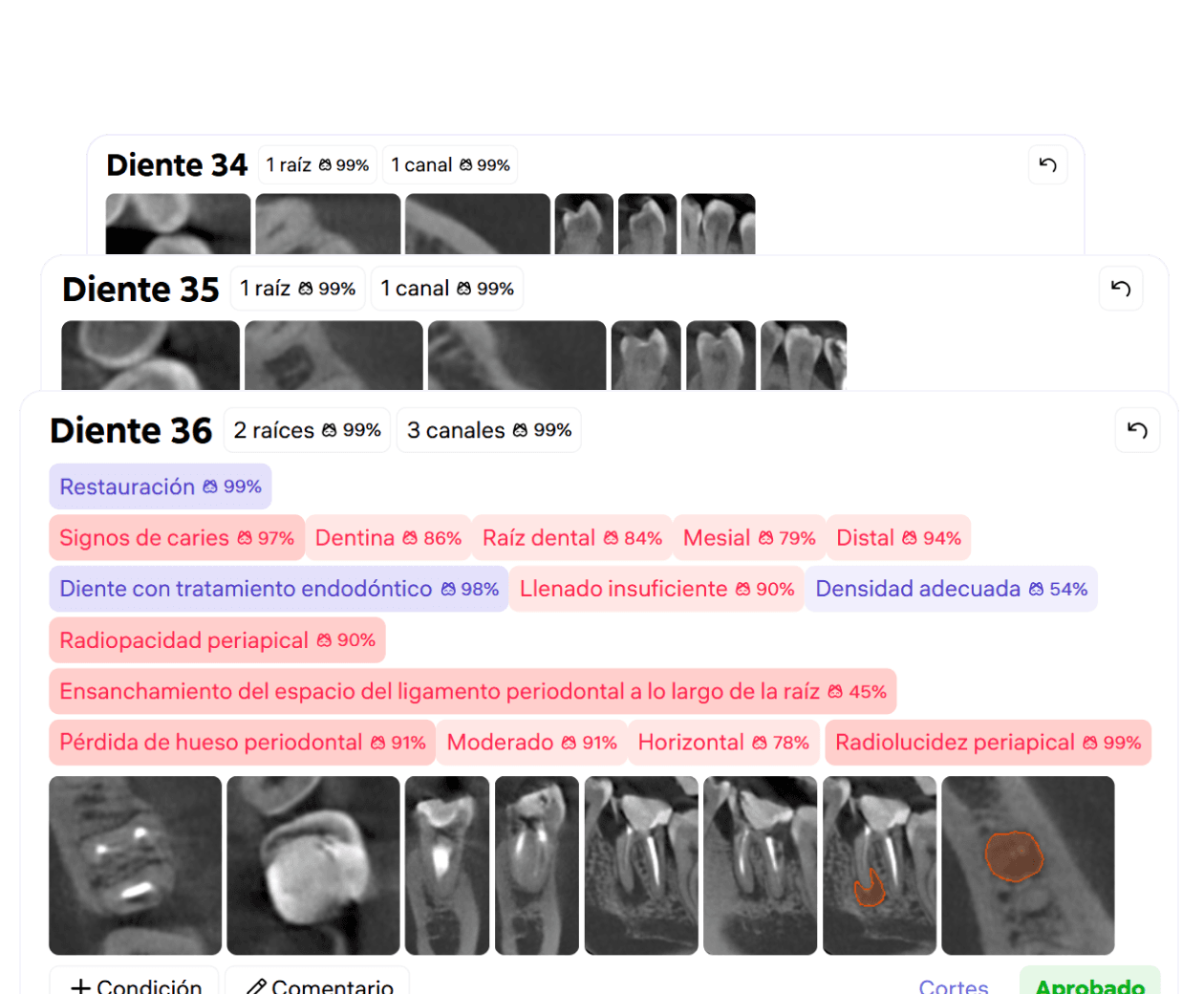 [object Object], Después de revisar las detecciones de Diagnocat, el profesional puede aceptarlas o corregirlas.