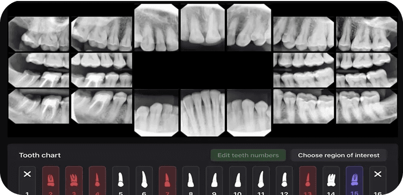 Artificial intelligence (AI) in dental diagnostics
