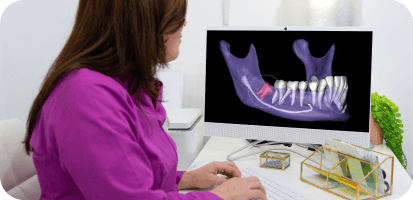 AI in Surgical Extractions of Impacted Teeth