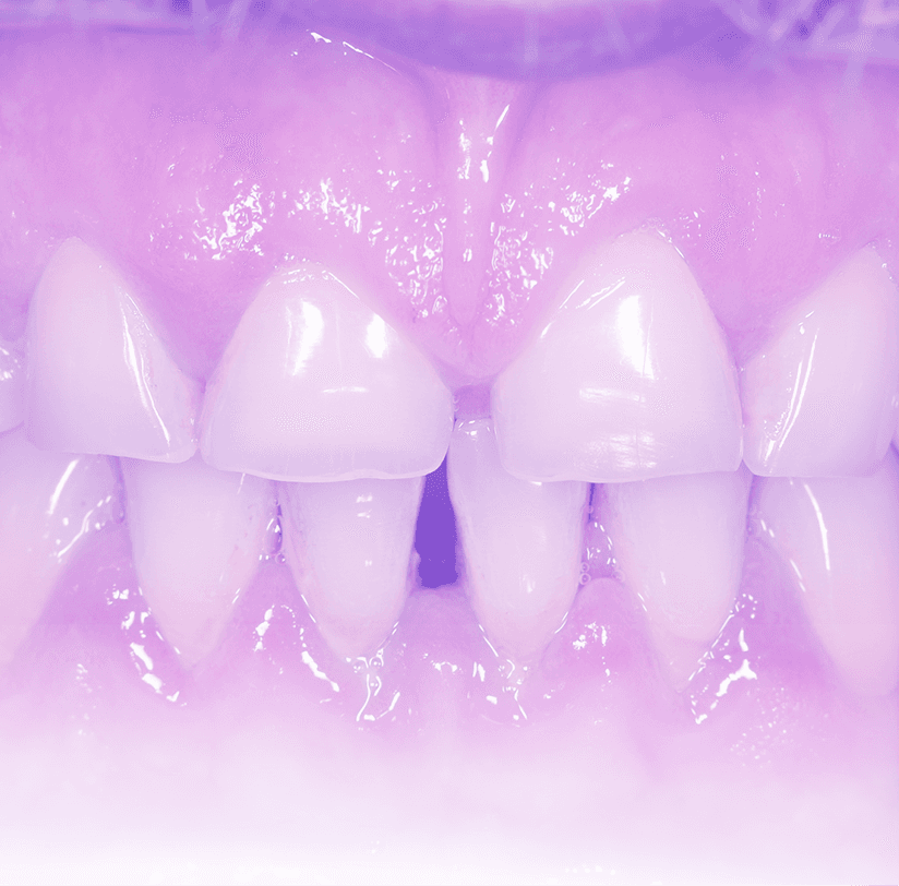 Advanced Periodontal Screening