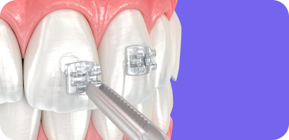 Revolutionising Orthodontics with AI