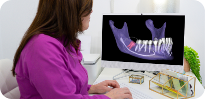 AI in Surgical Extractions of Impacted Teeth