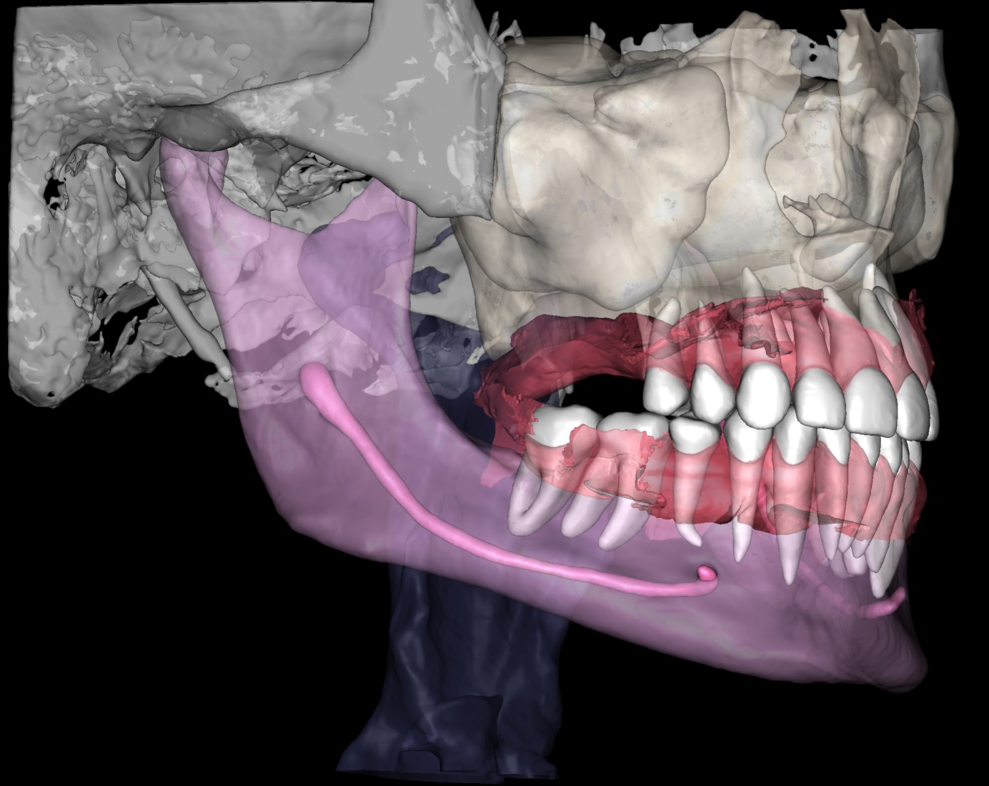 CBCT Segmentation 2