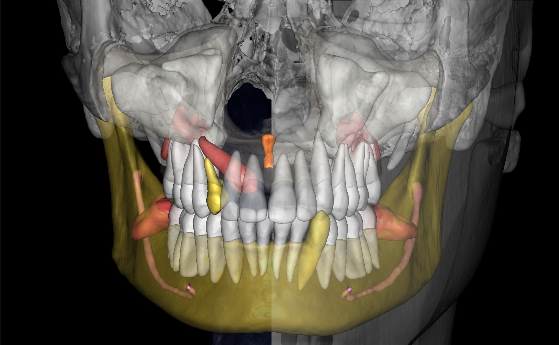 Orthodontist Case 1