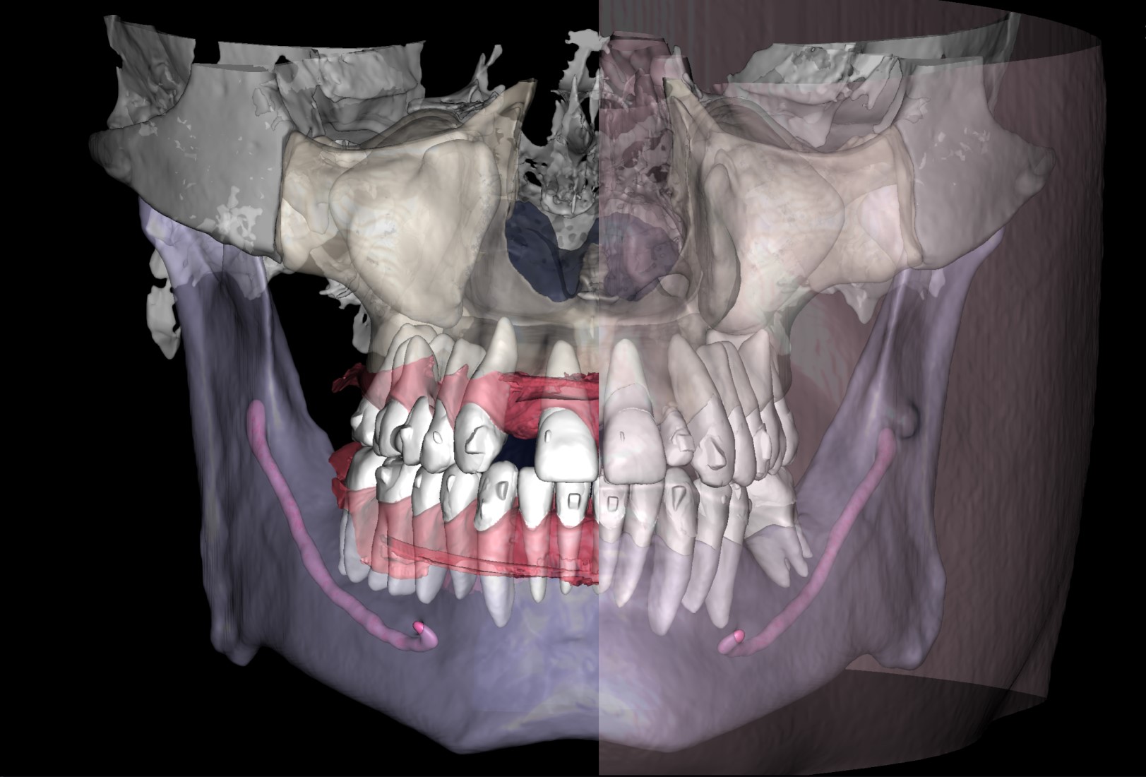 Orthodontist Case 2