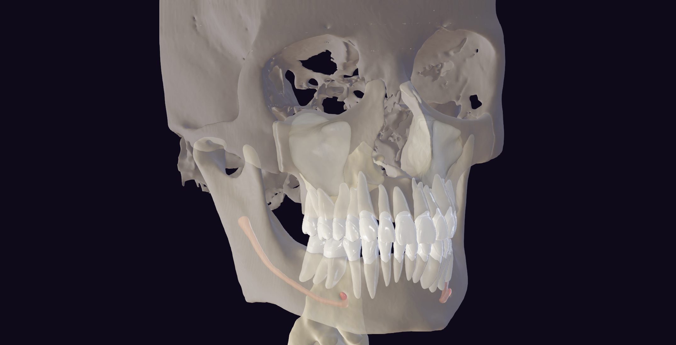 Сегментация STL/3D - Diagnocat