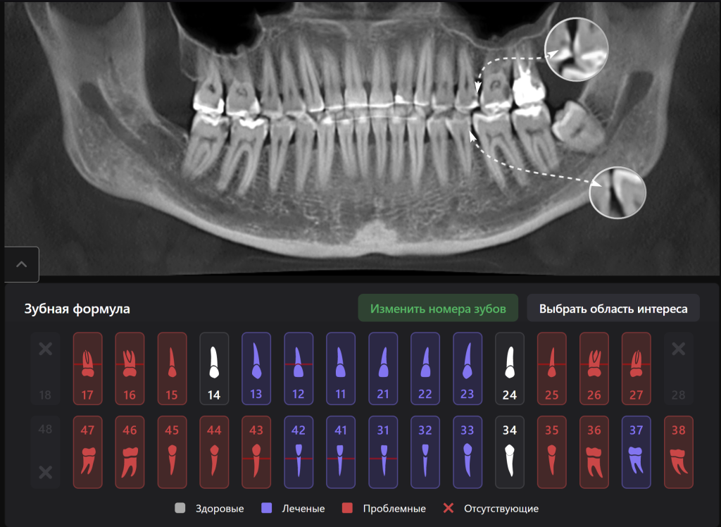 Diagnocat - ваш виртуальный ассистент стоматолога 1