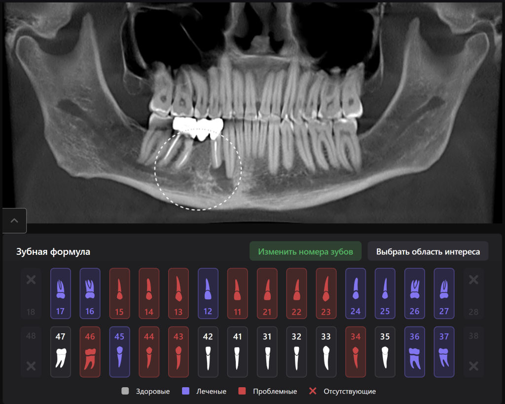 AI Diagnocat - помощник в планировании лечения 1