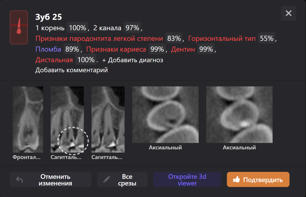 Diagnocat - ваш виртуальный ассистент стоматолога 3