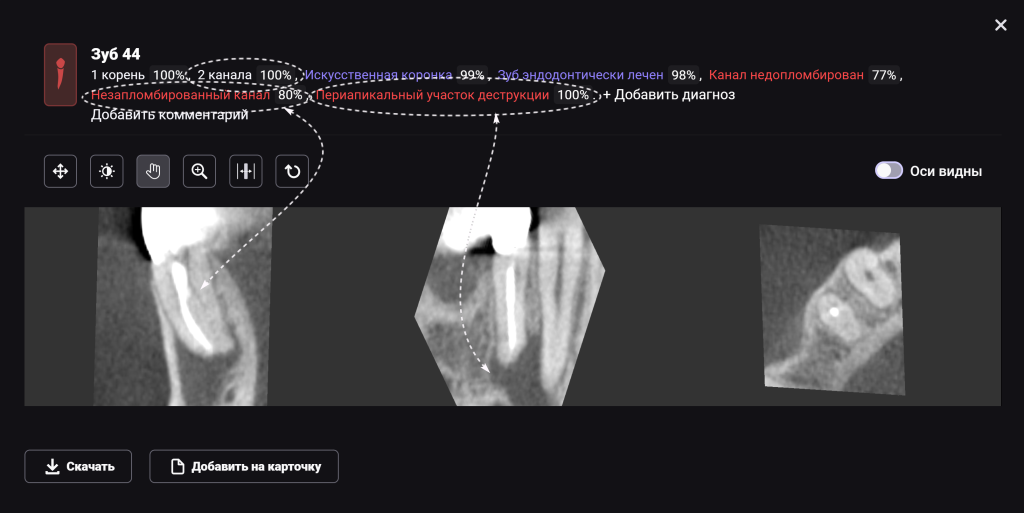 AI Diagnocat - помощник в планировании лечения 3