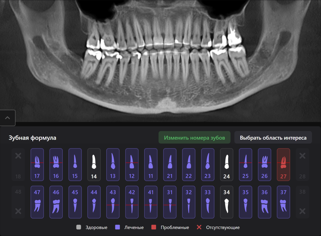 Diagnocat - ваш виртуальный ассистент стоматолога 11