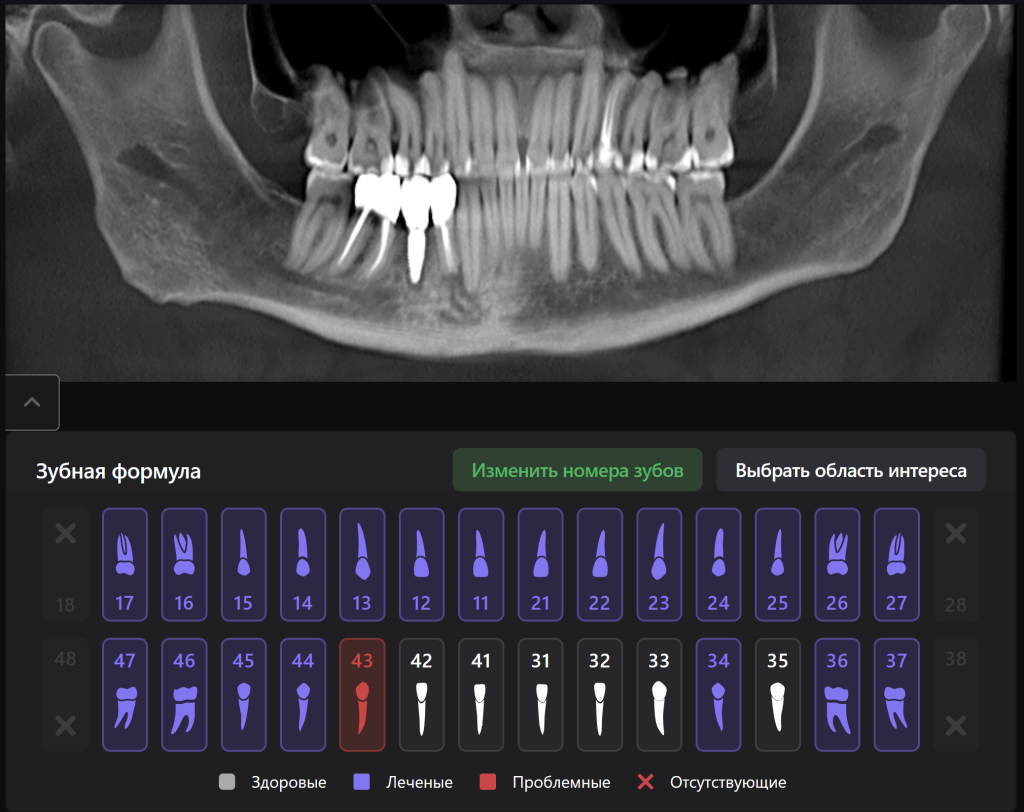 AI Diagnocat - помощник в планировании лечения 13