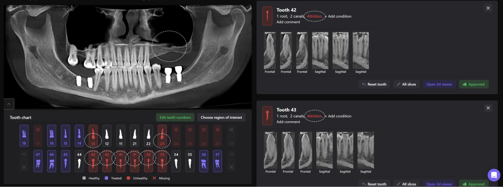 Implantatplanung zusammen mit dem Diagnocat STL-Modul 1