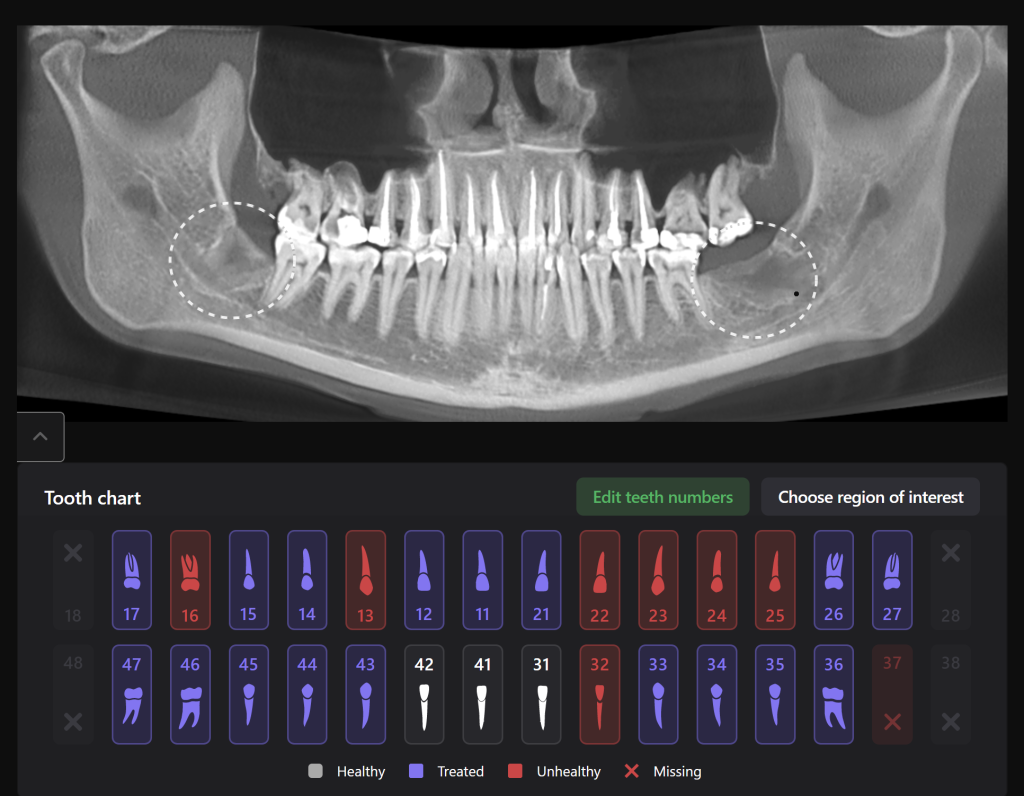 The projection of the jaw