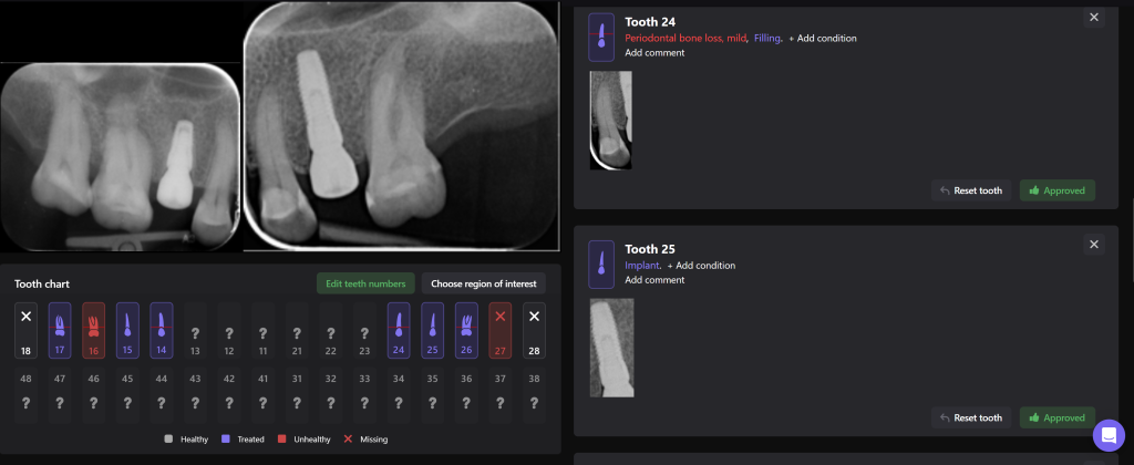 Simple Implant planning using the Diagnocat STL Module 7