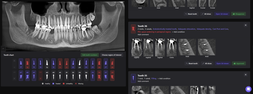 Diagnosis of frequent endodontic complications with Diagnocat 7