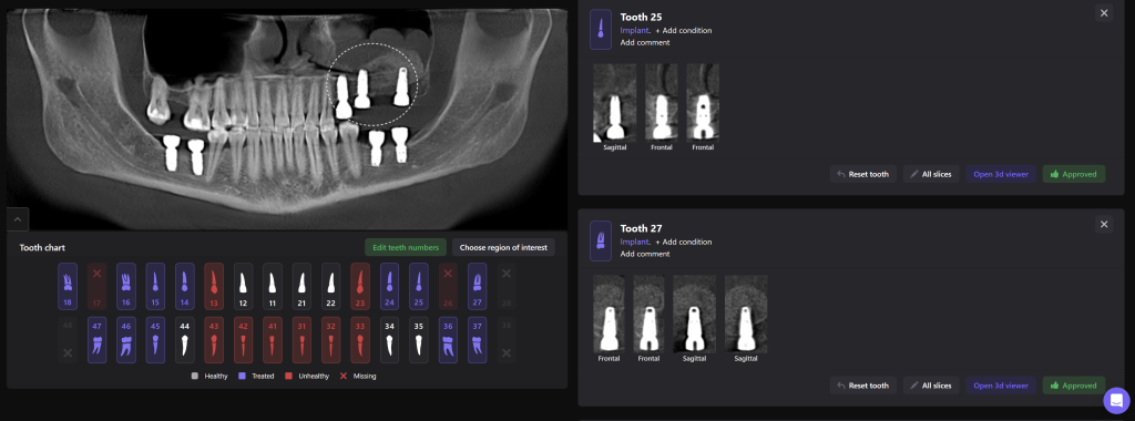 Implantatplanung zusammen mit dem Diagnocat STL-Modul 9