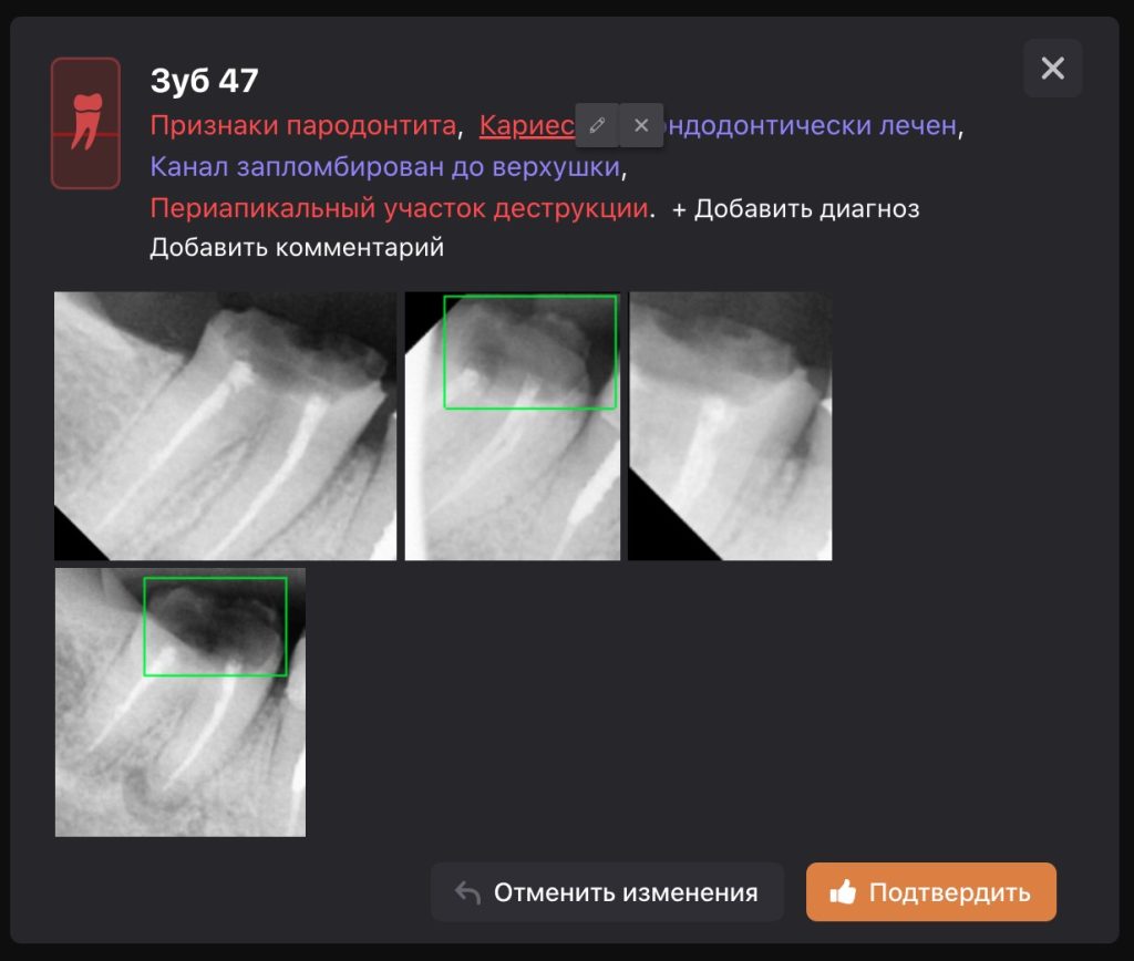 Рентгенологический отчет 11