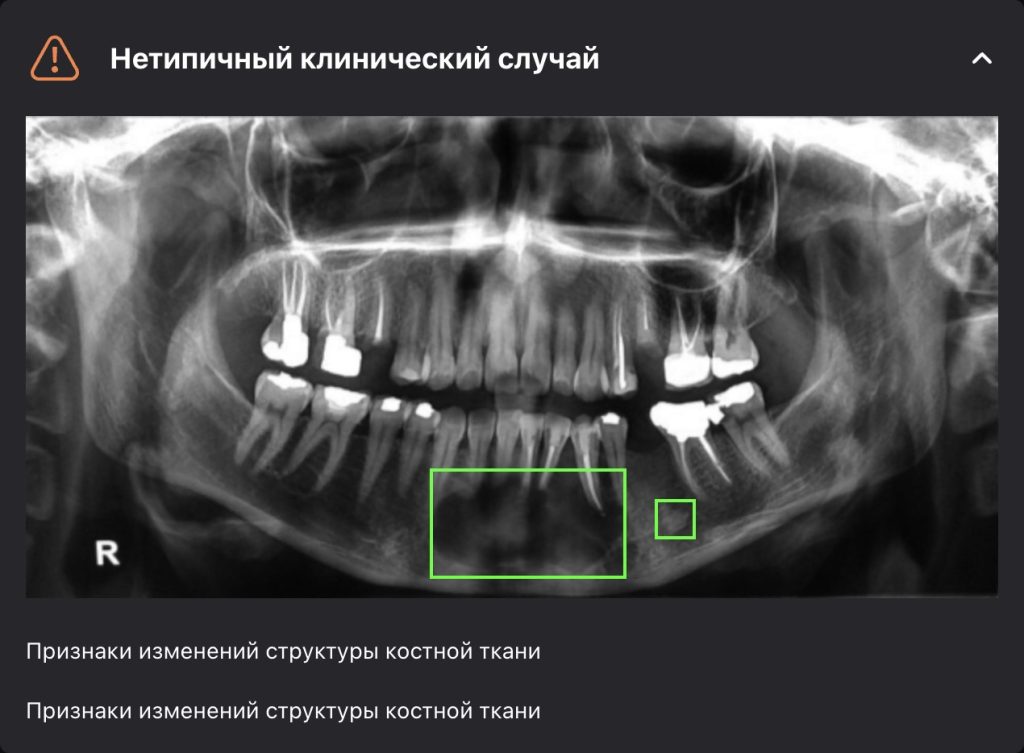 Рентгенологический отчет 19