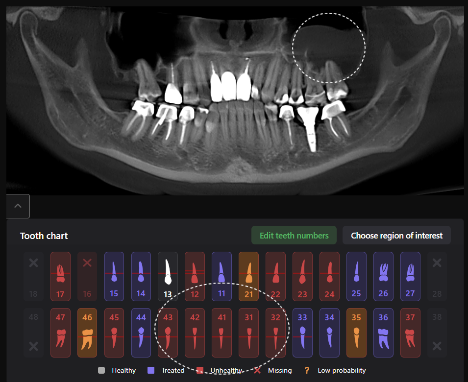 Periodontal disease srceening 1