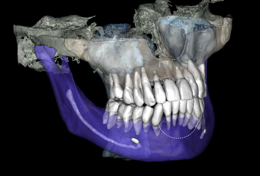 Periodontal disease srceening 5